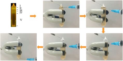 Exploring Needle Extraction Dreams: Shared Factors and Significance