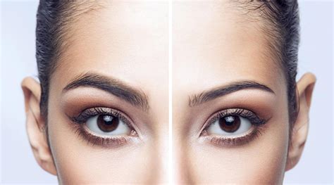 Exploring Professional Treatment Options for Thinning Brow Concerns