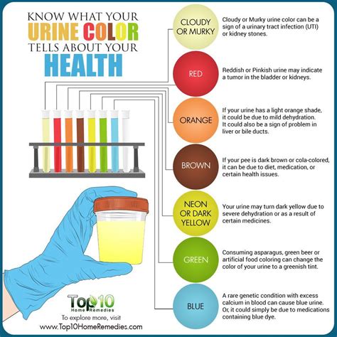 Exploring Treatment Options for Abnormal Yellow Urine