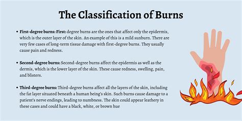 Exploring Various Types of Burns in Dream Imagery