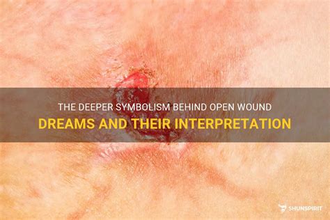 Exploring the Deep Symbolism within Dreams of Piercing Wounds