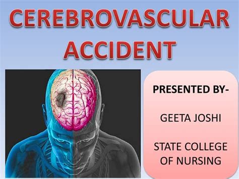 Exploring the Emotional Impact of Observing a Cerebrovascular Accident in a Dream