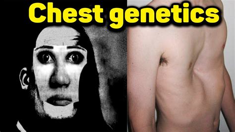 Exploring the Genetics Behind Chest Development