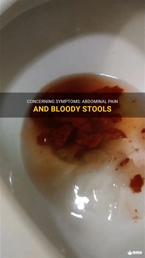 Exploring the Health-Related Interpretations of Dreams Involving Bloody Stool