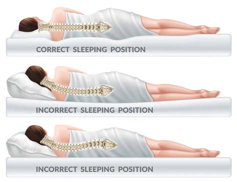 Exploring the Impact of Sleep Position on Neck Discomfort: Uncovering the Optimal Sleeping Alignment