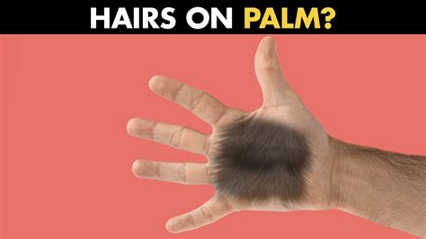 Exploring the Intriguing Phenomenon of Hair Growing on the Palms