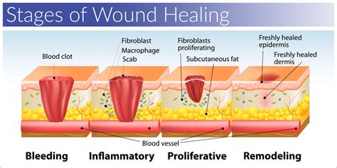 Exploring the Journey of Healing: From Open Wounds to Scar Tissues