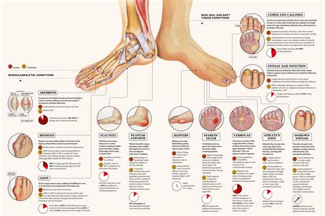 Exploring the Physical Health Conditions Associated with Dreams of Dysfunctional Feet