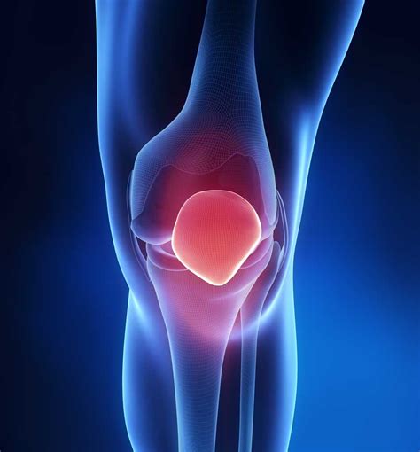 Exploring the Potential Significance of an Injured Patella in Oneiric Imagery