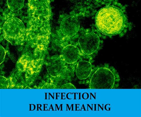 Exploring the Psychological Significance of Dreaming About Infections