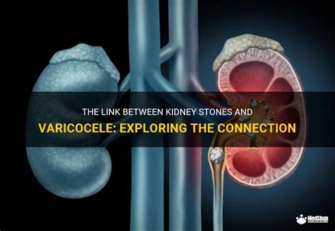 Exploring the Relationship between Kidney Extraction Fantasies and Personal Bonds