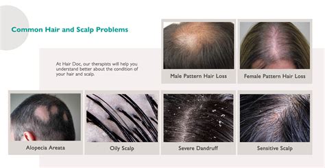 Exploring the Root Causes: Common Scalp Conditions