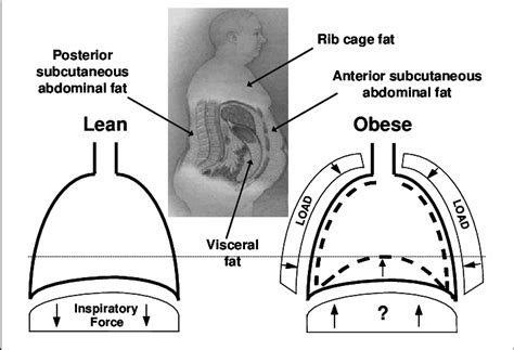 Exploring the Science Behind Accumulation of Abdominal Fat