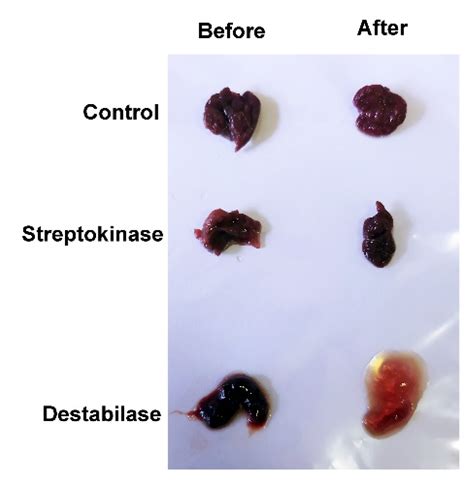 Exploring the Significance of Different Sizes and Shapes of Menstrual Blood Clots