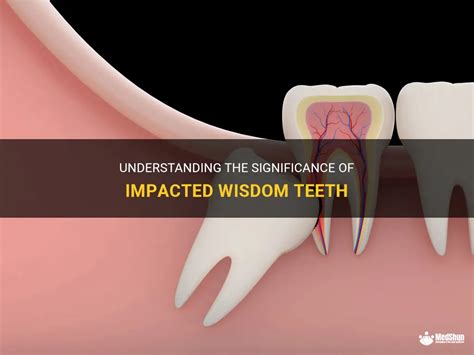 Exploring the Significance of a Breaking Wisdom Tooth as a Symbol of Transformation and Evolution