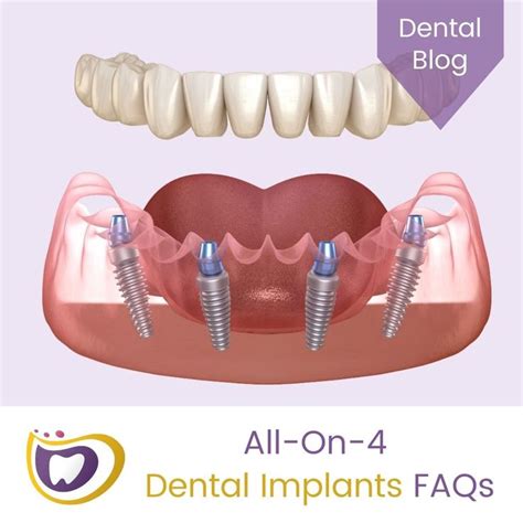 Exploring the Significance of the Widespread Phenomenon: Understanding the Common Dream of Dental Realignments