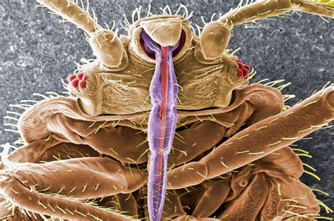 Exploring the Terrifying Realm of Human Parasites