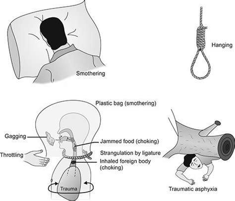 Exploring the physiological factors that may trigger dreams of asphyxiation with a spherical object