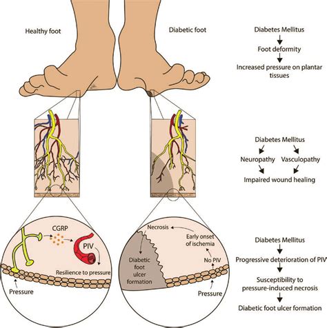 Factors Contributing to the Occurrence of Fasteners in Foot-Related Dreams