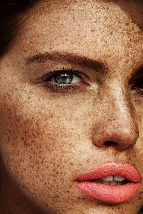 Freckles' Impact on Fashion and Beauty