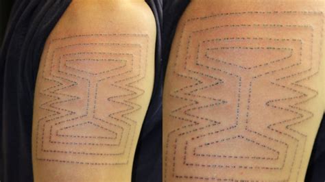 From Fashion to Art: How Skin Stitching has Transformed the Perception of Dermal Material