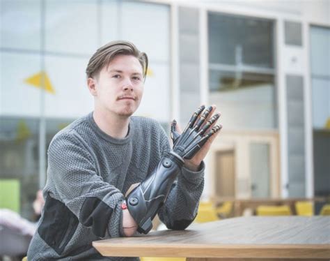 From Science Fiction to Reality: Bionic Limbs Inspired by Pop Culture