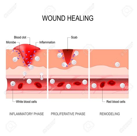 Healing Wounds: Discovering Resolution through a Serendipitous Reunion