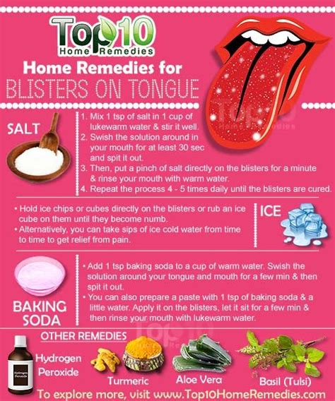 Home Remedies for Alleviating Tongue Swelling