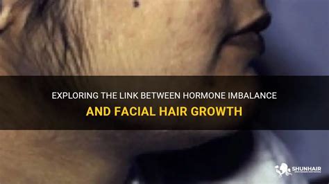 Hormonal Imbalances and Unruly Hair: Exploring the Link