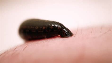 How Leeches on Feet Dreams May Reflect Emotional Drainage and Energy Loss