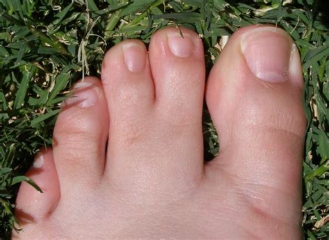 Implications for our Daily Lives: The Role of Toes Stuck Together in Maintaining Balance