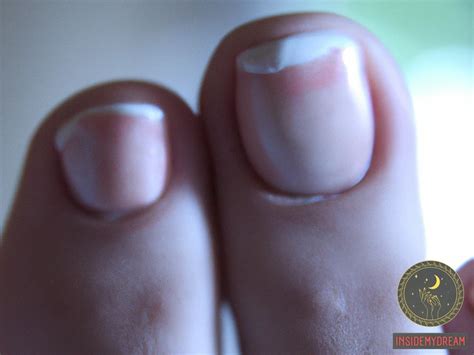 Insights into the Psychological Significance of Toenail Dream Imagery