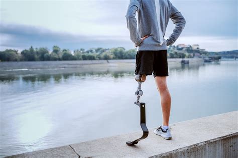 Inspiring Stories: Achieving the Aspiration of Acquiring a Prosthetic Limb