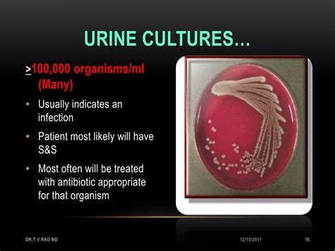 Interpreting Dreams of Hematuria in Different Cultures