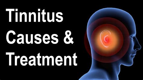 Investigating the Impact of Stress on Experiencing Tinnitus in Dreams