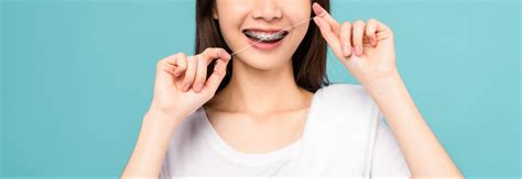 Life After Orthodontic Treatment: Maintaining Your Beautiful Smile