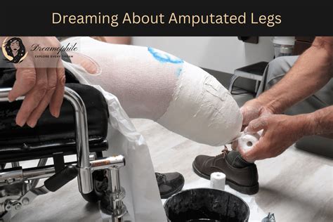 Linking Dreams of Amputated Legs to Feelings of Loss and Powerlessness