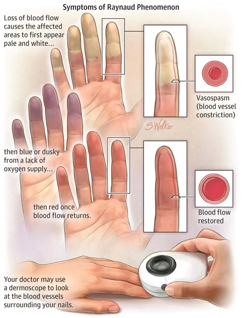 Medical Conditions Associated with the Astonishing Phenomenon