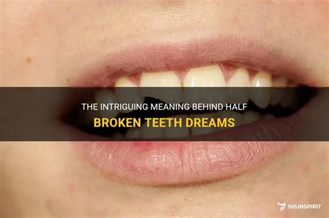 Messages from the Subconscious: The Intriguing Significance of Teeth in Dreams