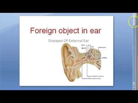 Modern Scientific Explanations for Dreams Involving Extraction of Foreign Objects from the Ear