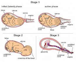 Navigating the Physical Challenges: Examining the Bodily Changes and Symptoms During the Initial Stages of Labour