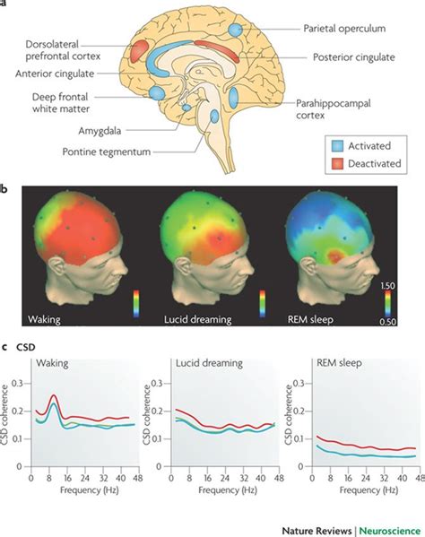 Neuroscience Insights: Exploring Brain Activity During Dream States