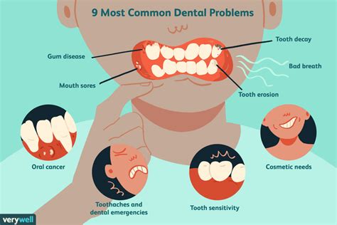 Physical Attributes: Dental Issues and their Connection to Dreams of Teeth Becoming Jammed