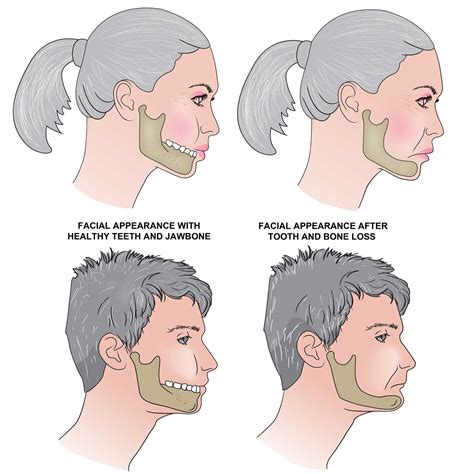 Physical Factors Contributing to Dreams About Deteriorating and Losing Teeth