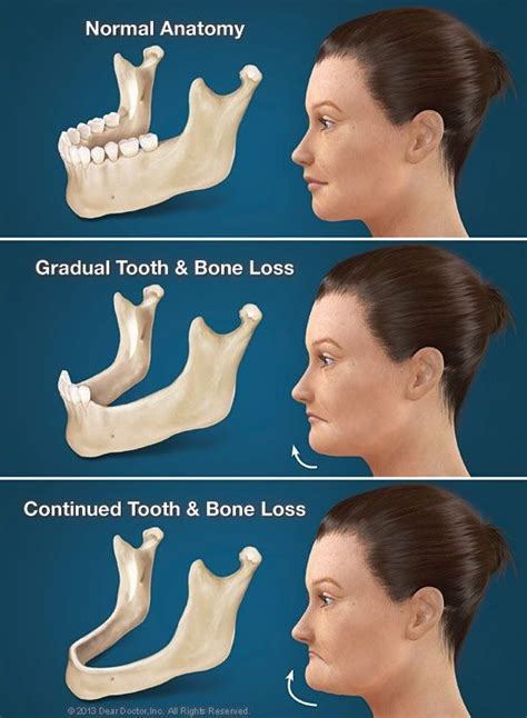 Physical Factors that May Impact Dreams of Dental Deterioration