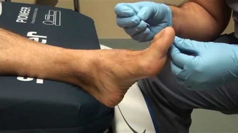 Pin Pricks in Feet: A Fascinating Psychological Phenomenon