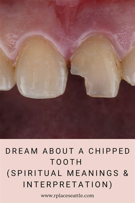 Possible Explanations for Dreams about Breaking the Front Tooth