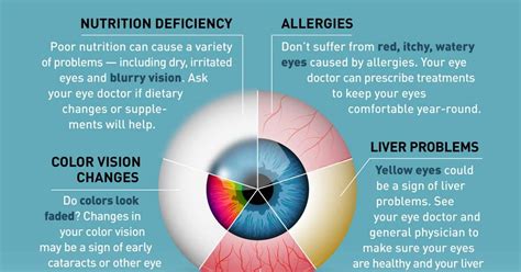 Possible Health Issues Associated with Changes in Eye Color