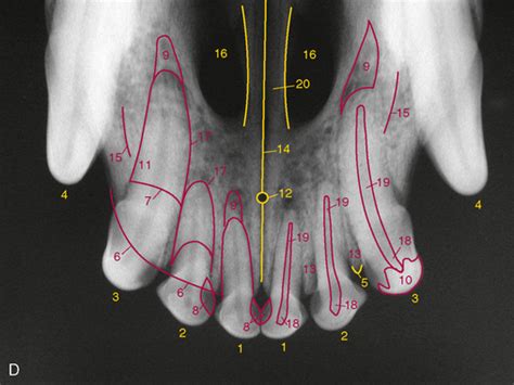 Possible Interpretations of Canine Incisor Dreamscapes