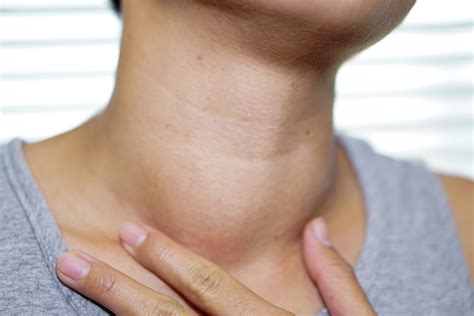 Potential Causes of Neck Swelling: From Infections to Tumors